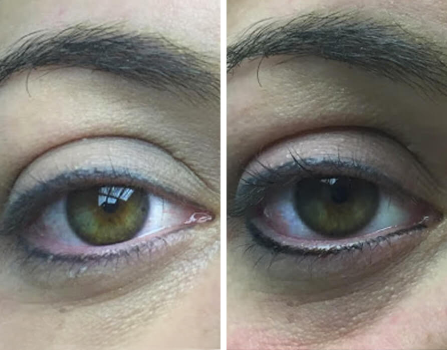 Eye Liner - Before and After