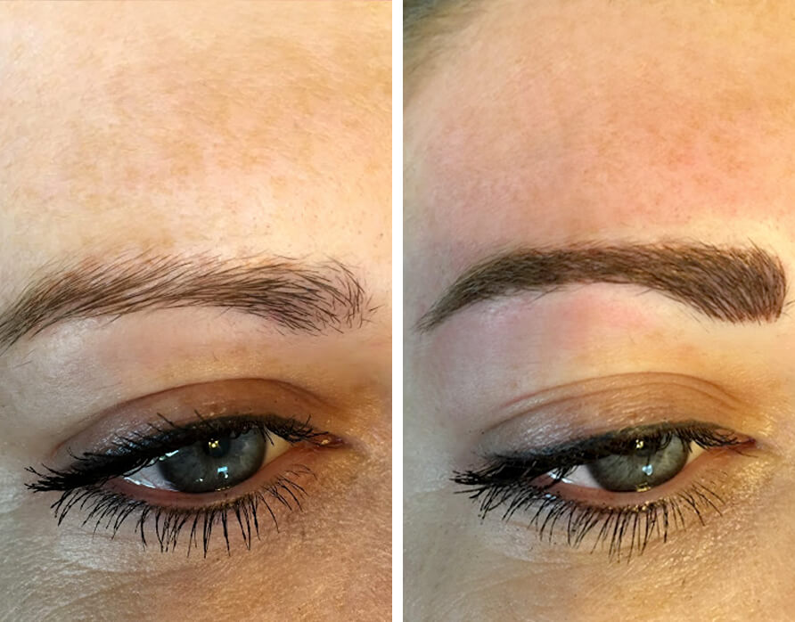 Eyebrows - Before and After